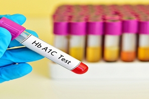 Hba1c a test that measures your blood sugar for 3 months